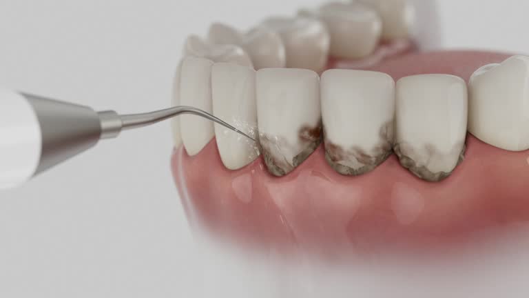 Trusted Tooth Extraction service in Rosedale, MS - Dentist Open Now